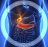 Gallstone Treatment image